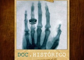 Doc. Histórico: Radiografia